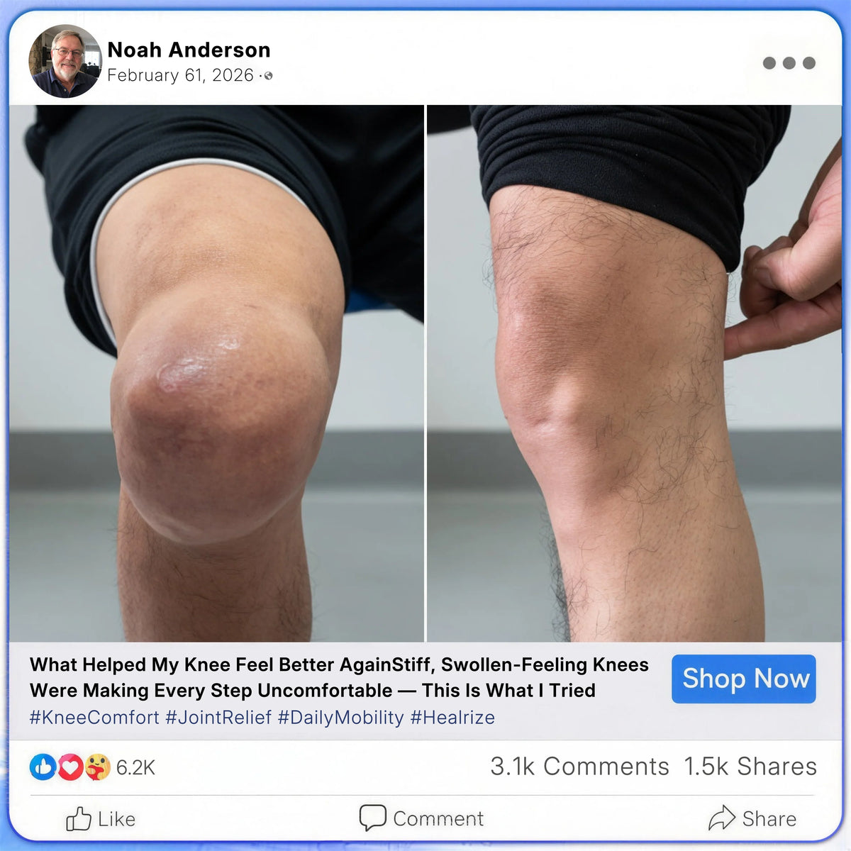 [cs] Healrize® Bee Venom Joint Relief Cream 🦵Powerful Bee Venom Cream for Joint & Muscle Pain Relief – Feel Comfort in Minutes
