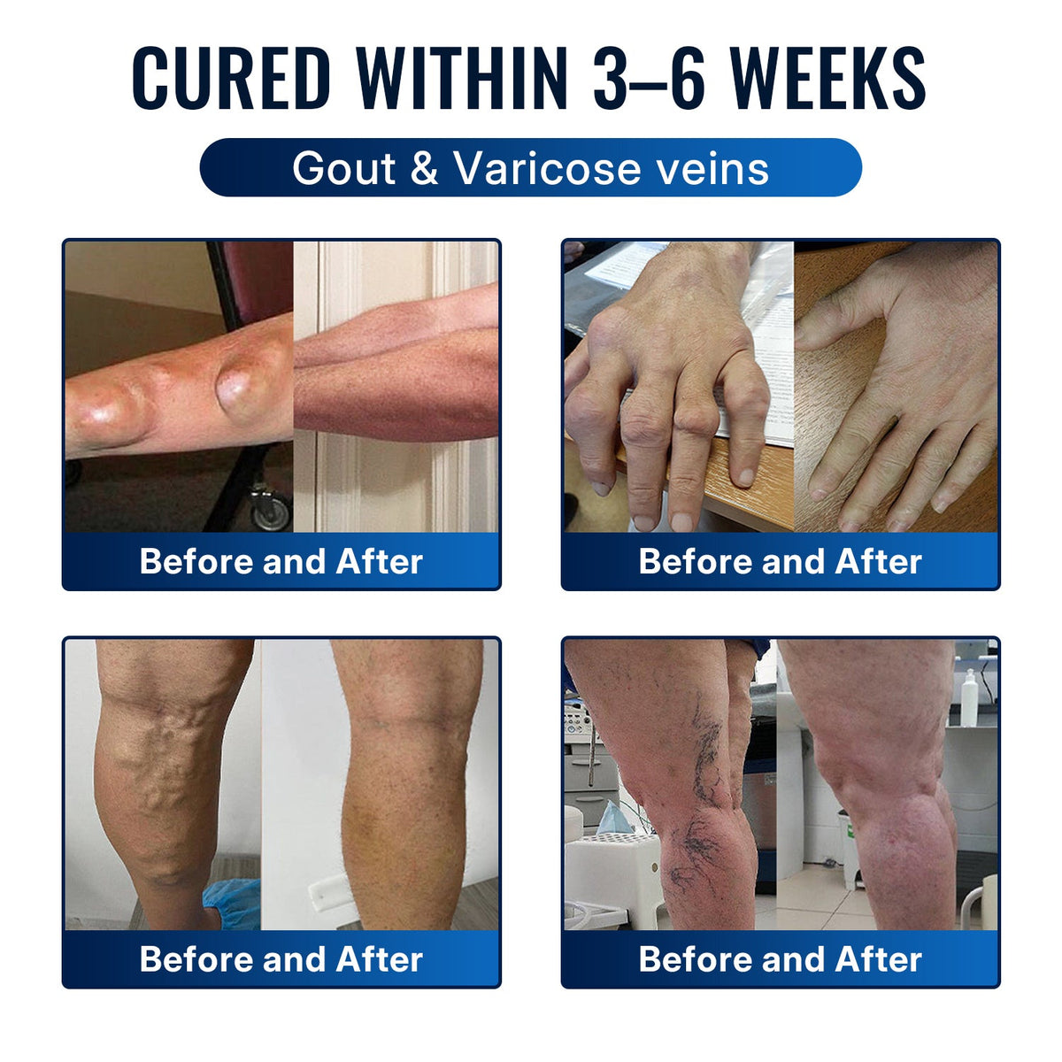 [Only 10 minutes left!] Healrize® Bee Venom Joint Relief Cream 💪Targets stiff, sore joints in knees, hands, shoulders, back & more — so you can move easier every day