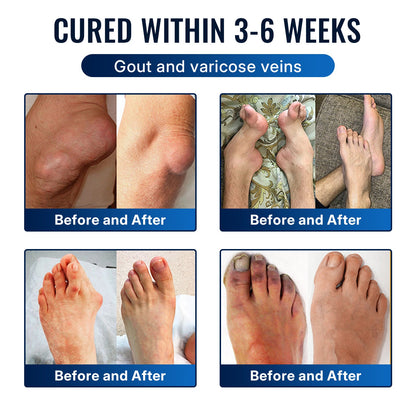 [Only 10 minutes left!] Healrize® Bee Venom Joint Relief Cream 💪Targets stiff, sore joints in knees, hands, shoulders, back & more — so you can move easier every day