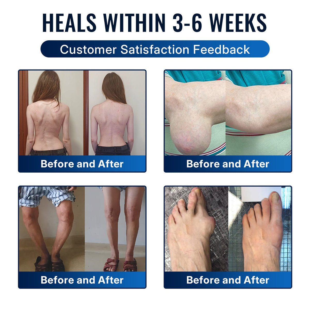 🎁Healrize® Bee Venom Joint Relief Cream 💞Fast-Acting Comfort for Stiff Knees, Hands, Back & Everyday Joint Discomfort