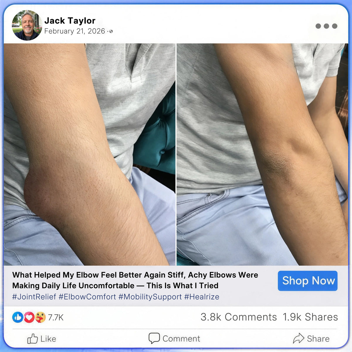 [cs] Healrize® Bee Venom Joint Relief Cream 🦵Powerful Bee Venom Cream for Joint & Muscle Pain Relief – Feel Comfort in Minutes