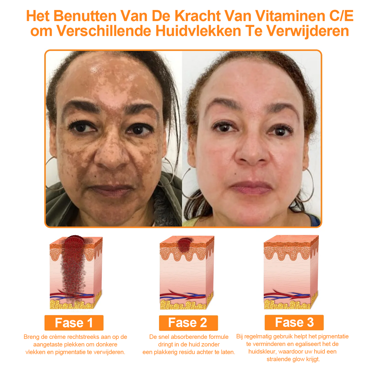 Turonu™ 7-daagse multi-effect alles-in-één huidverzorgingscrème (aanbevolen door de Nederlandse Vereniging voor Dermatologie en Venereologie - NVDV)👨‍⚕️⭐